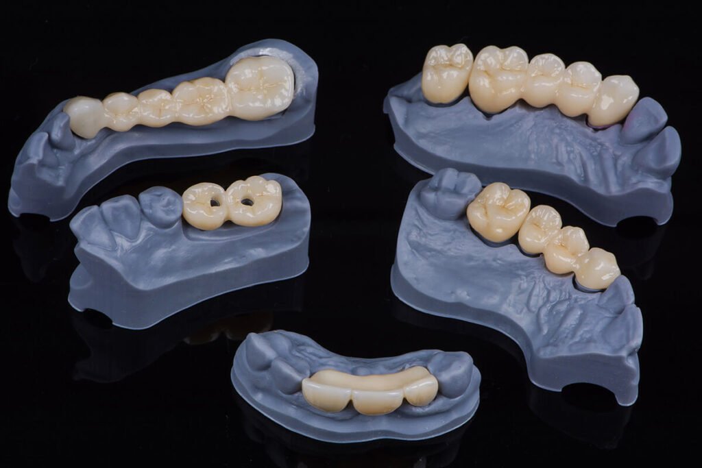 3D-Druck in der Zahnmedizin