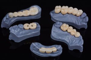 3D-Druck in der Zahnmedizin