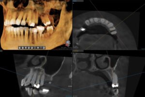 Röntgendiagnostik in der Zahnmedizin: Ist sie schädlich?