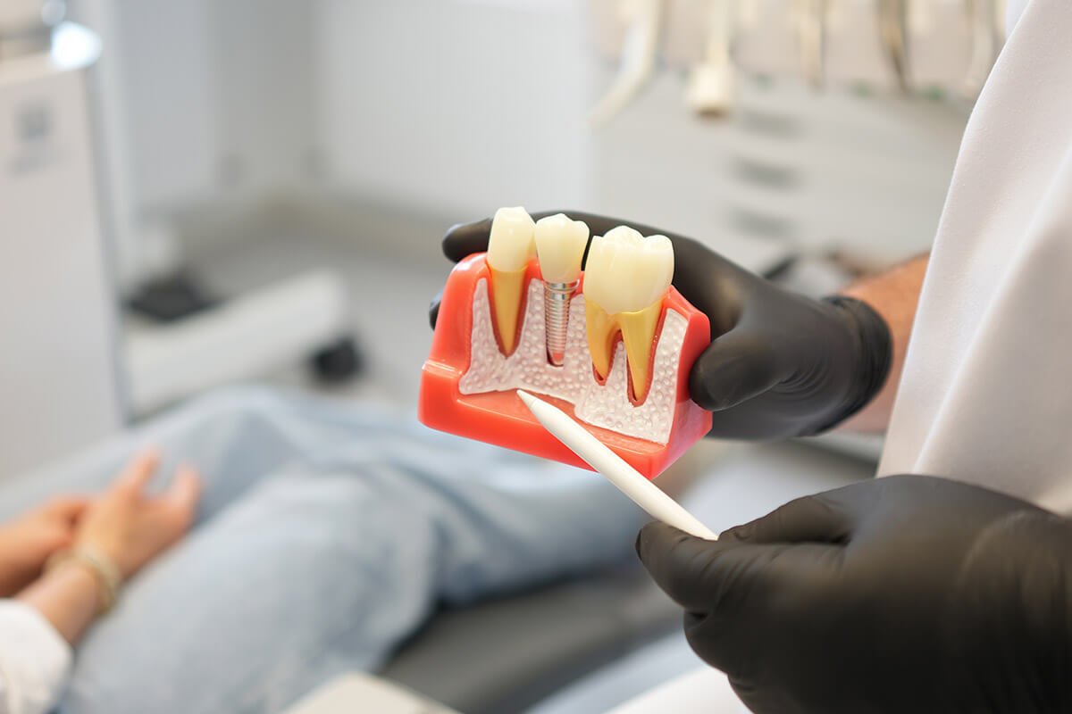 Zahnimplantate