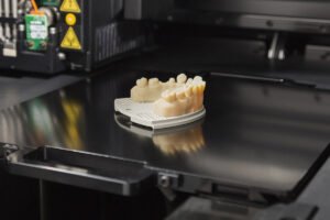 3d-druck-zahnarzt-klagenfurt