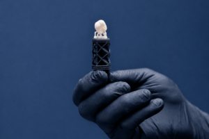 3D-gedruckte Inlays, Onlays und Kronen – Digitale Zahnversorgung in der modernen Zahnmedizin